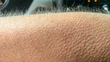 Image 12 of 19 -
            Experience the Wim Hof Method to get an impression of  at 